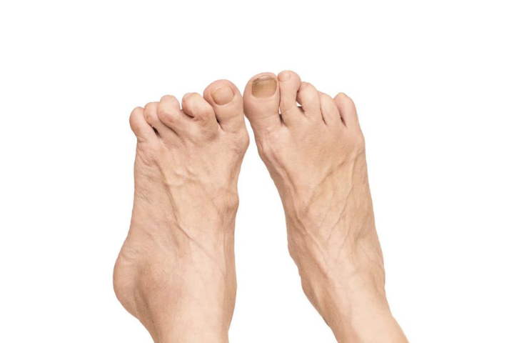 Understanding Arthritis: Causes, Symptoms, and Natural Ways to Find Relief