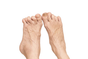 Understanding Arthritis: Causes, Symptoms, and Natural Ways to Find Relief