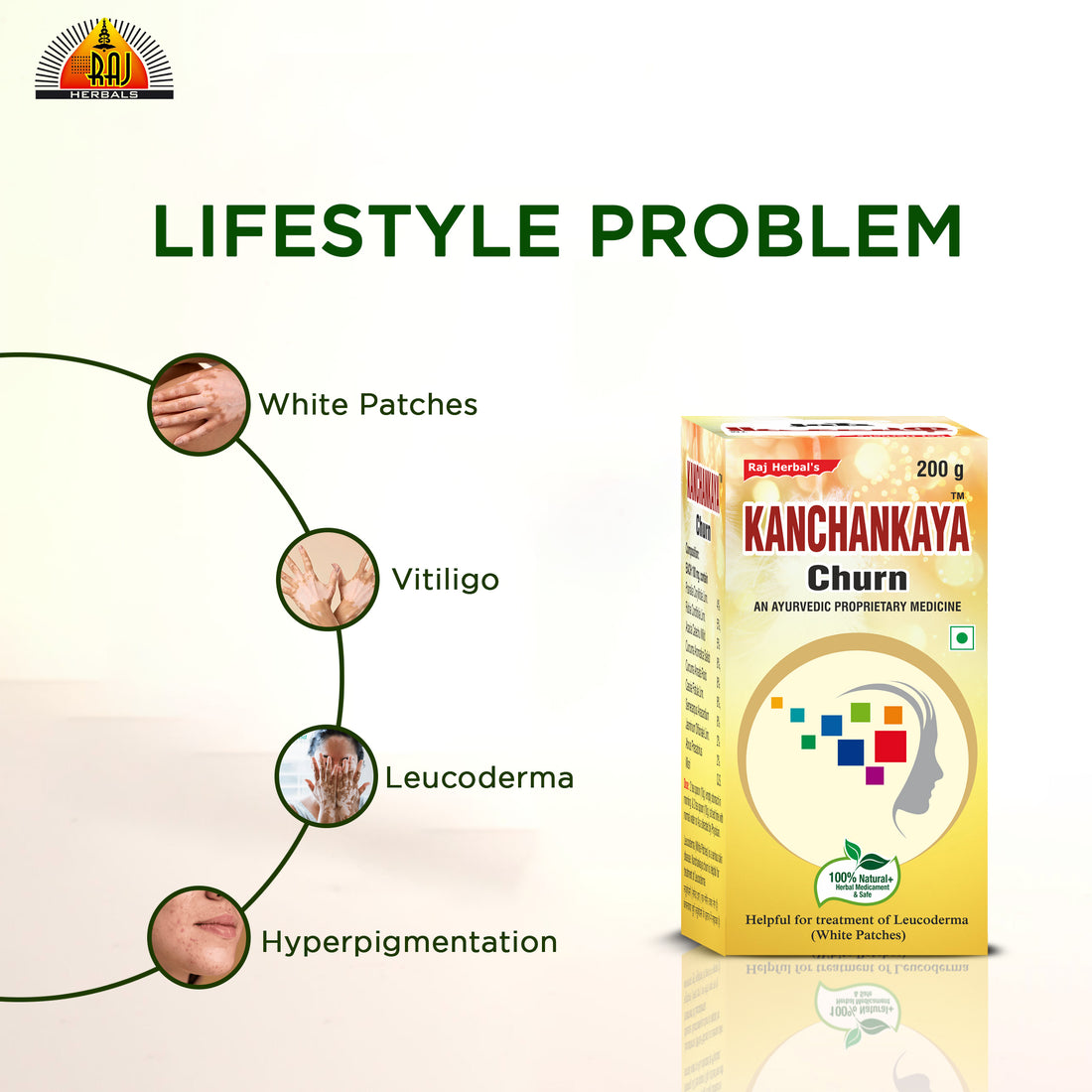 Kanchankaya Churn - Pack of 1 Bottle | Ayurvedic Solution for Vitiligo